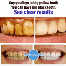 Load image into Gallery viewer, Super Probiotic-6 Toothpaste